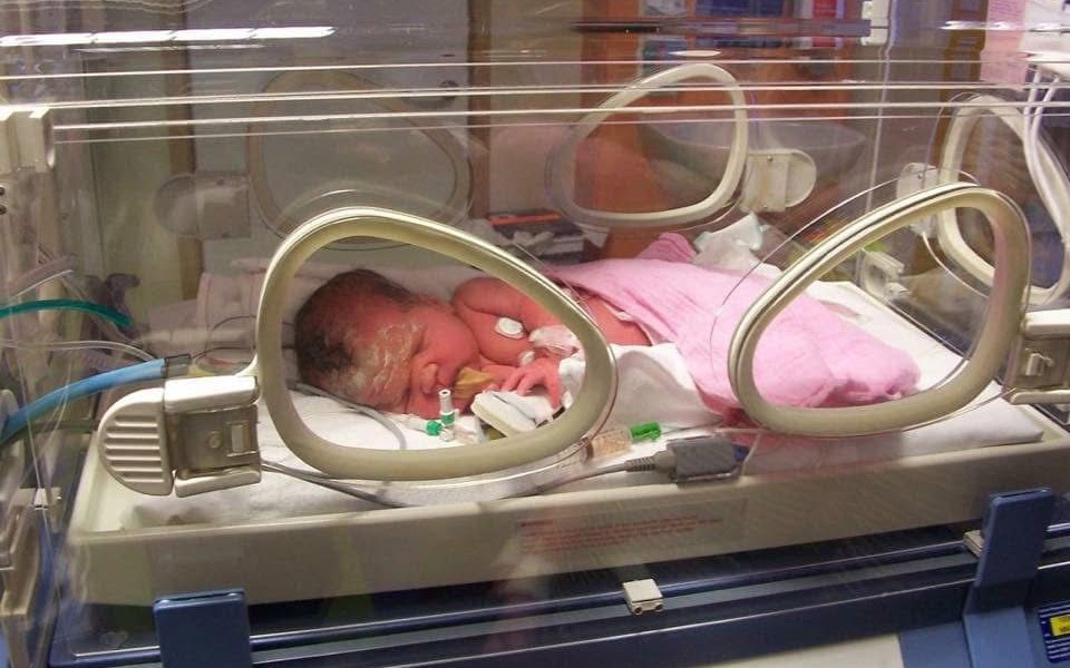 Charlie as a baby in an incubator